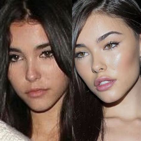 madison beer plastic sugery|Madison Beer Has Addressed Plastic Surgery Rumors。